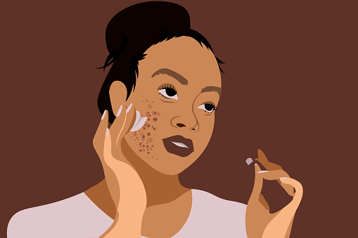 Bid a good bye to your acne scars